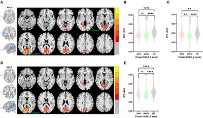 Altered dynamic functional connectivity of auditory cortex and medial geniculate nucleus in first-episode, drug-naïve schizophrenia patients with and without auditory verbal hallucinations